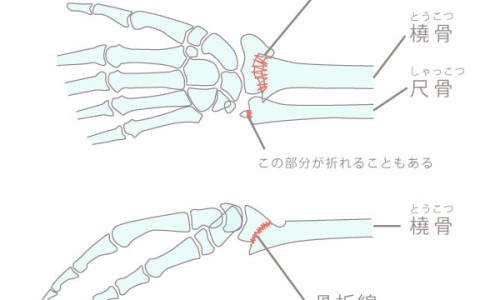 地奈德乳膏和派瑞松的区别-地奈德乳膏和派瑞松的区别网 - 为你提供地奈德和皮炎平区别、地奈德乳膏和皮炎平一样吗
