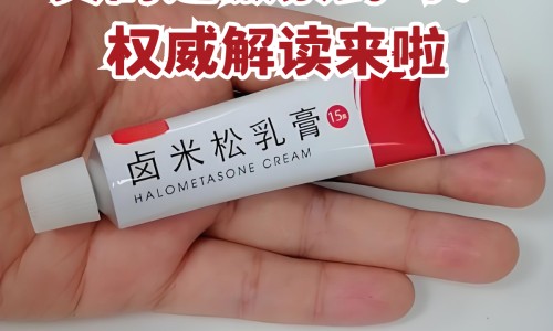 地奈德乳膏和派瑞松的区别-地奈德乳膏和派瑞松的区别网 - 为你提供地奈德和皮炎平区别、地奈德乳膏和皮炎平一样吗